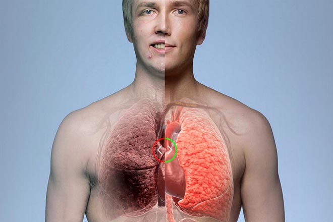 Хто запускає соціальну рекламу в Фінляндії