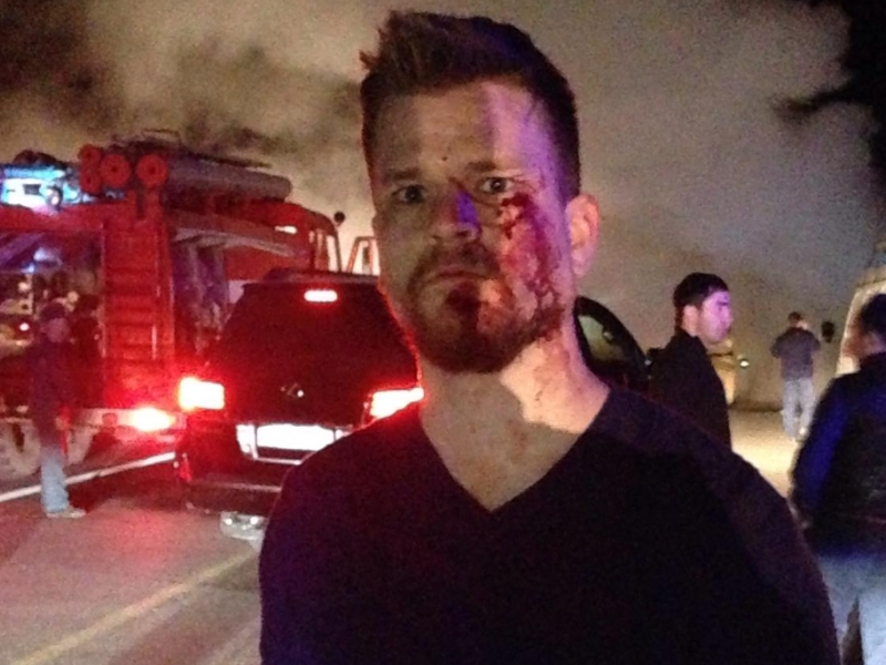 Ойстен Віндстад після нападу