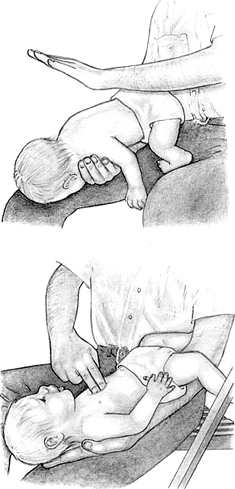 У разі якщо всі докладені зусилля не привели до повного відновлення дихання, викликайте швидку медичну допомогу